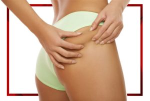 TRATAMIENTO BODY SCULPTOR